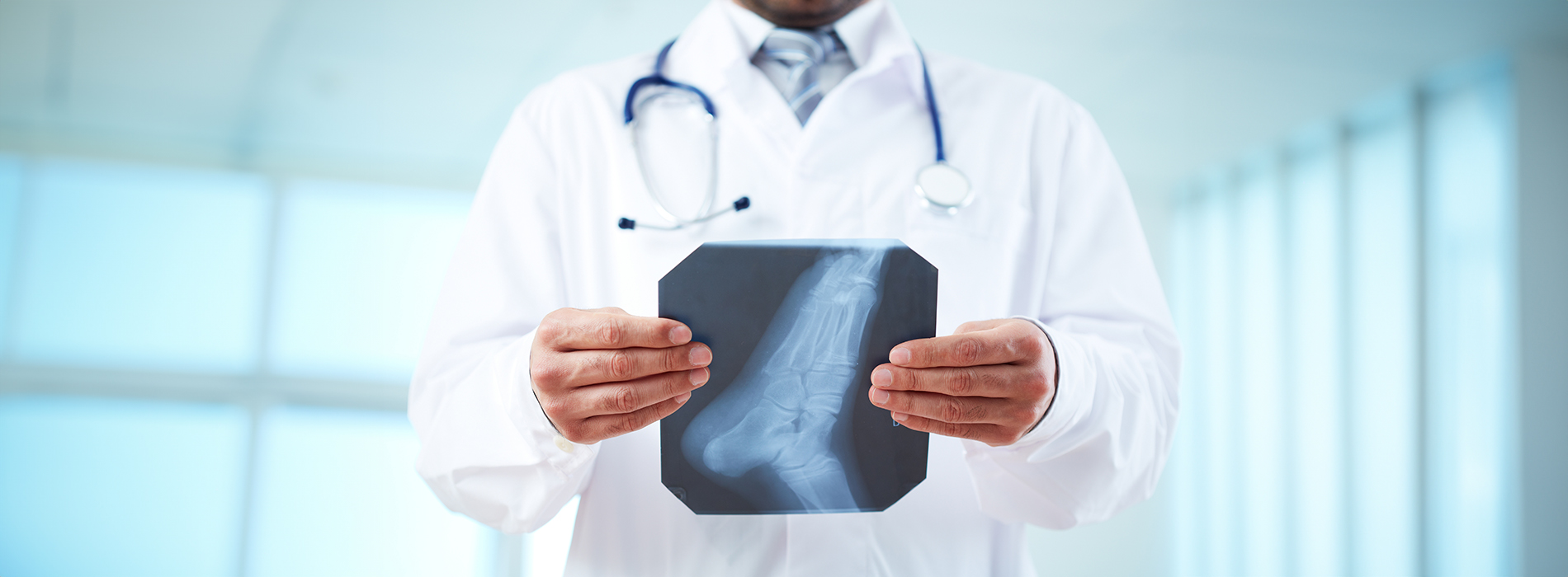 The image depicts a medical professional, likely a radiologist or X-ray technician, holding up an X-ray film for viewing.