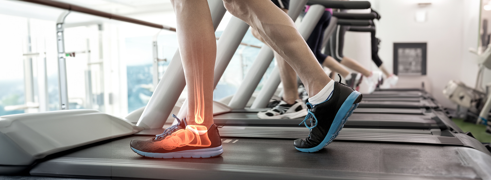 A person jogging on a treadmill with orange knee braces.